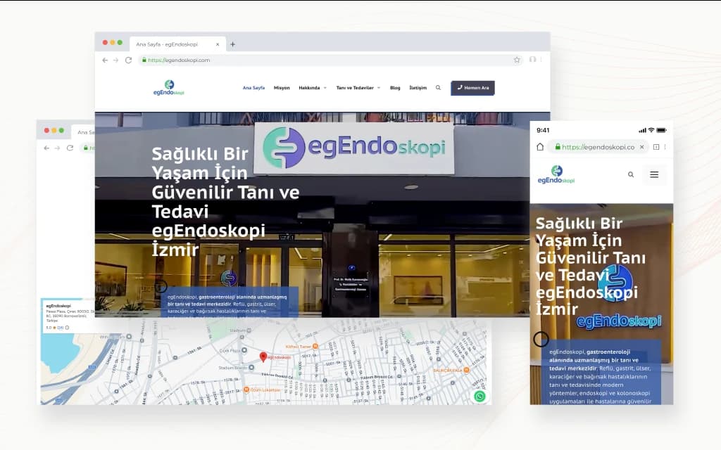 Egendoskopi